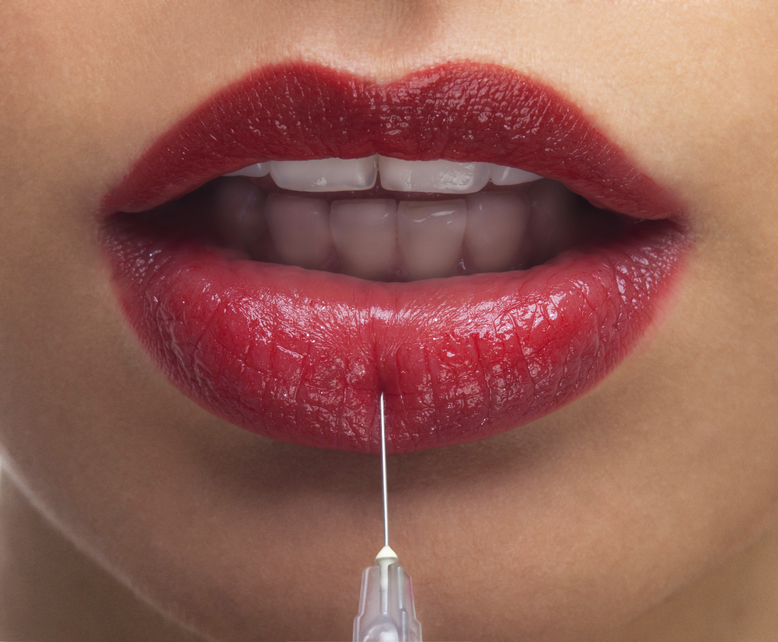 tratamientos de aumento de labios